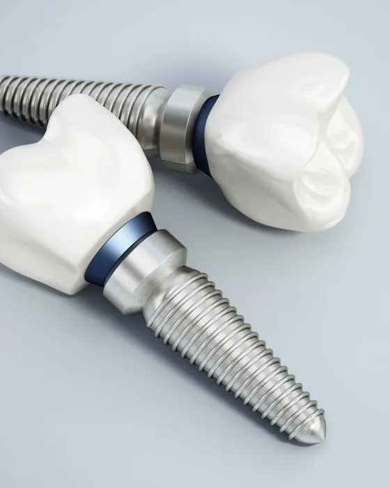 Implant crowns on titanium implant fixtures